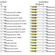 Development of a lateral flow recombinase polymerase amplification assay for rapid and visual detection of Cryptococcus...